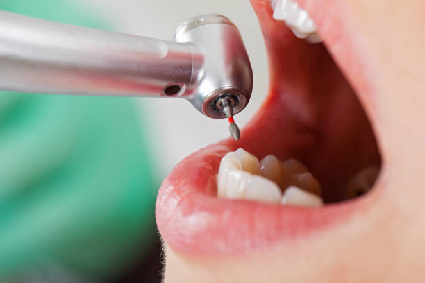 Best Walk-In Emergency Dentist in Santa Cruz, CA